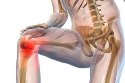 Arthrose des Kniegelenks